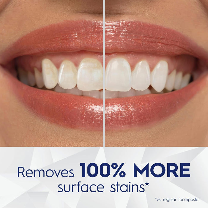 fluoride formula for anticavity protection and enamel strengthening