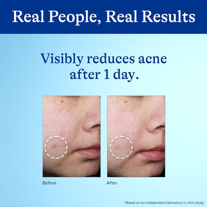 unscented, targeted spot treatment applicator