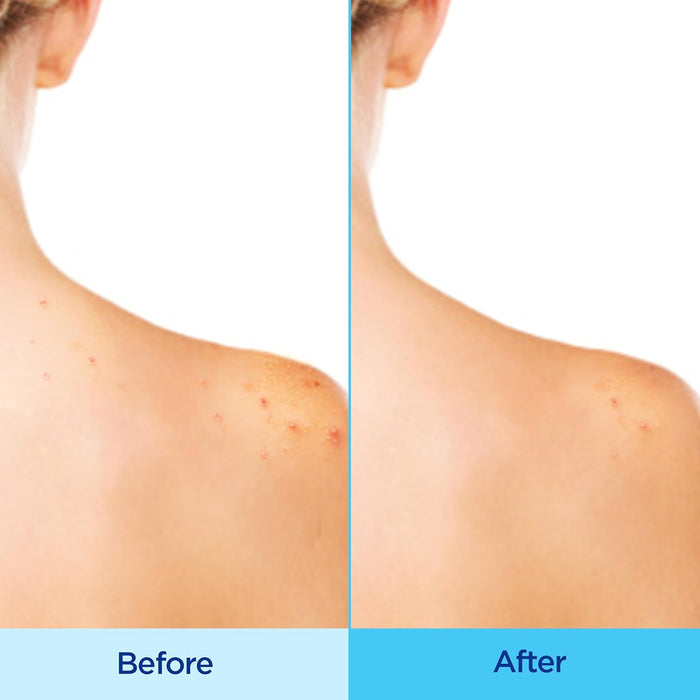 2.5% witch hazel to control surface oil and minimize pore appearance