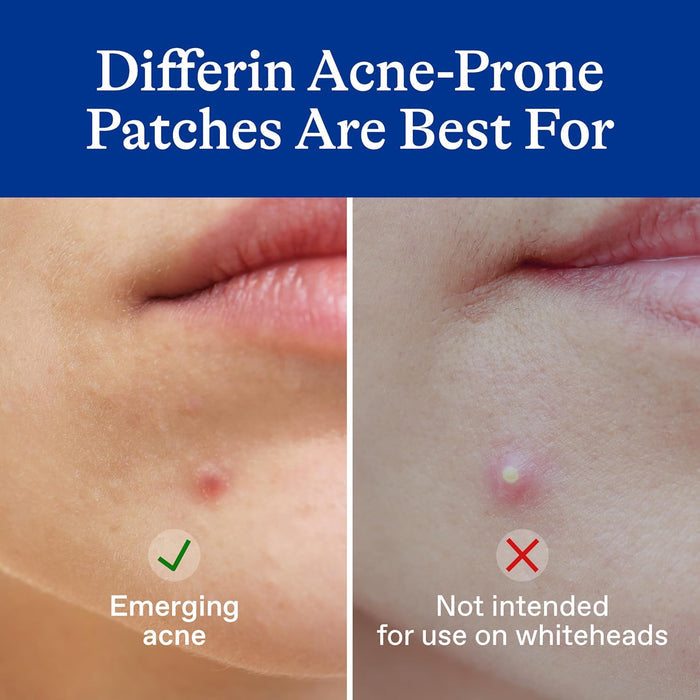 ultra-thin invisible patch construction compatible with makeup application