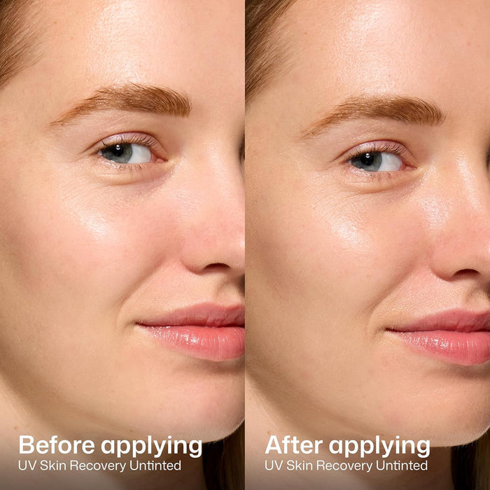 fragrance-free and safe for sensitive, rosacea-prone, and post-procedure skin