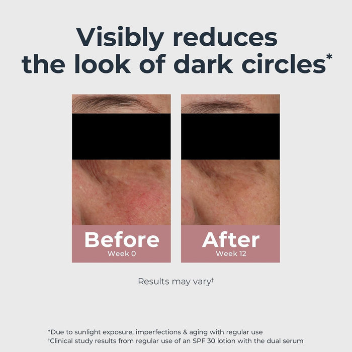 hyaluronic acid for hydration and minimizing the look of under-eye puffiness