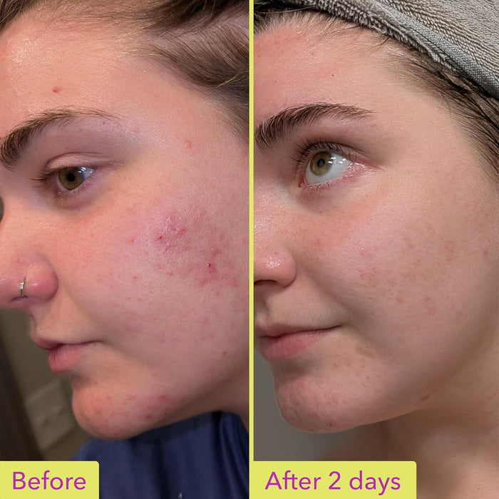 lightweight, non-greasy gel texture that absorbs quickly