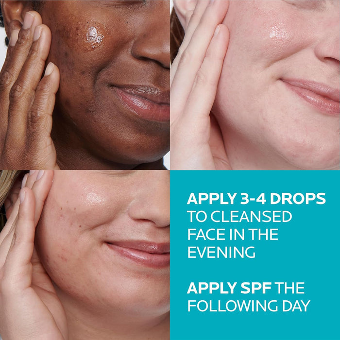 niacinamide to reduce post-acne marks and support skin barrier