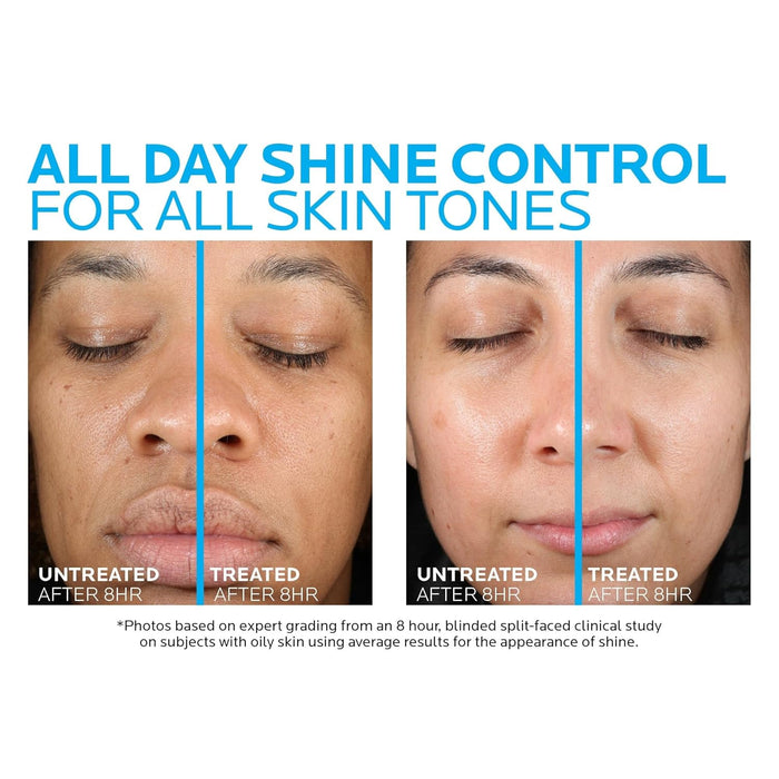 ceramide-3 for skin barrier restoration within 1 hour