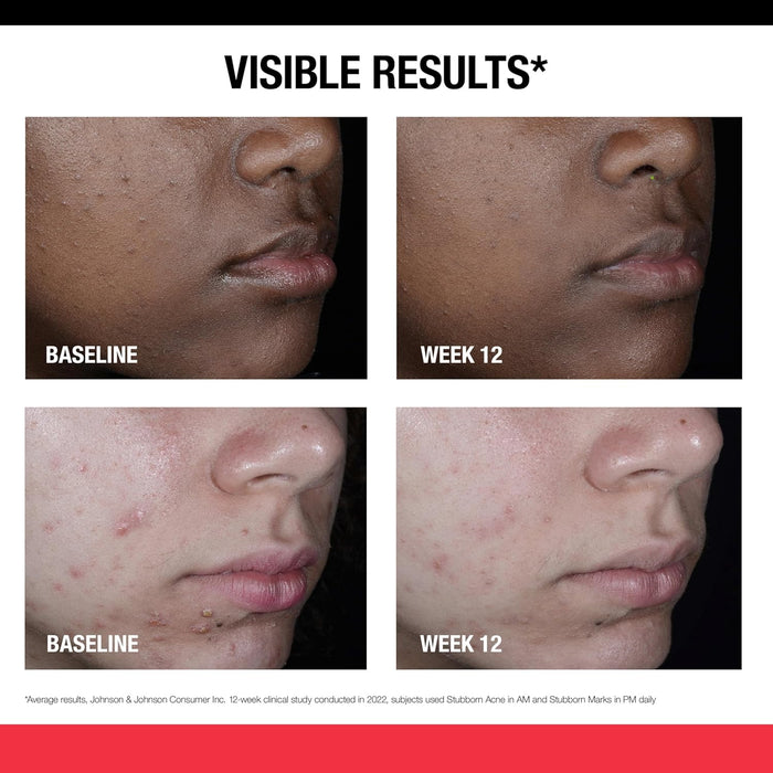non-comedogenic and oil-free base