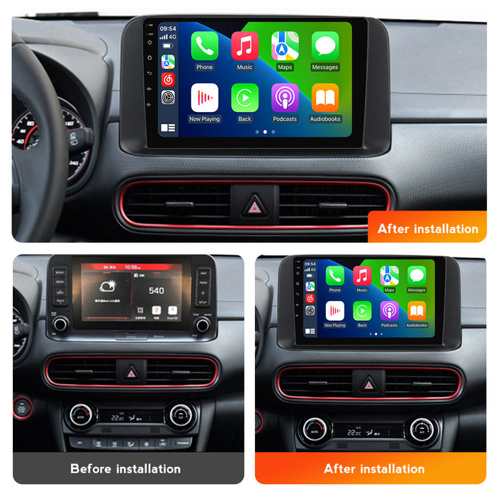 Suitable for hyundai encino 2018-2020 hyundai encino radio car android navigator