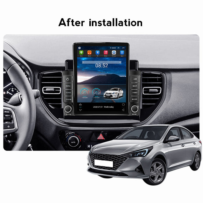 Suitable for hyundai solaris 2 2020-2021 vertical screen android smart navigator stone monument machine