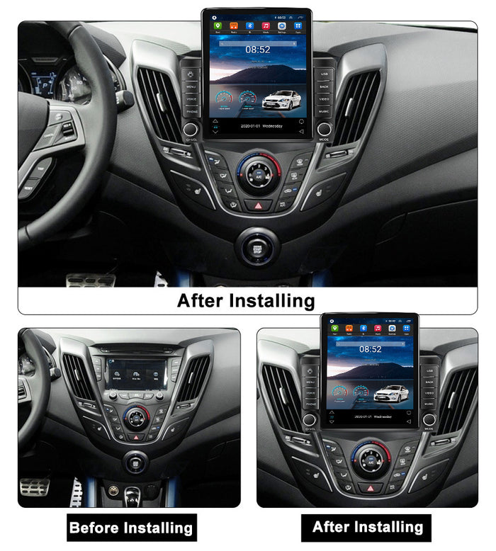 Suitable for hyundai veloster android navigation system with carplay (vertical screen, stone tablet style)