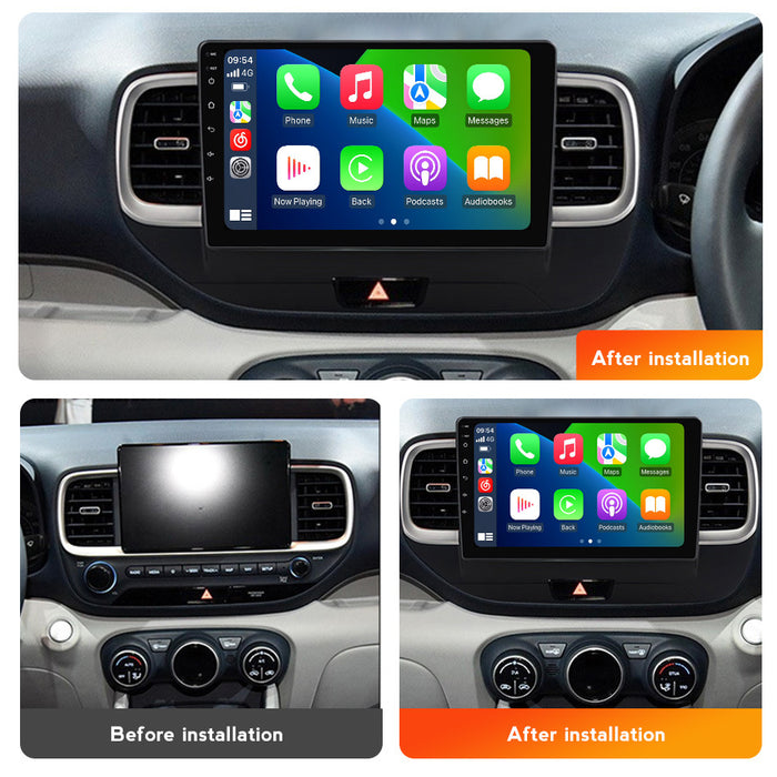 Suitable for hyundai venue 2019-2020 rhd hyundai ix25 car android smart navigator